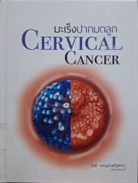 Image of มะเร็งปากมดลูก = Cervical cancer / บรรณาธิการ จิตติ หาญประเสริฐพงษ์